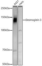 Desmoglein 3 Antibody in Western Blot (WB)