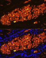 HBA2 Antibody in Immunohistochemistry (Paraffin) (IHC (P))