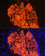 HBA2 Antibody in Immunohistochemistry (Paraffin) (IHC (P))