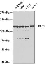 SAP97 Antibody in Western Blot (WB)