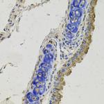 GAS6 Antibody in Immunohistochemistry (Paraffin) (IHC (P))