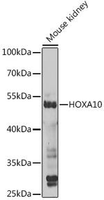 HOXA10 Antibody in Western Blot (WB)