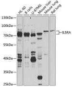 IL5RA Antibody in Western Blot (WB)