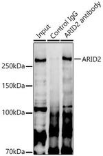 ARID2 Antibody in Immunoprecipitation (IP)