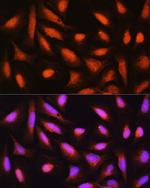 GMFB Antibody in Immunocytochemistry (ICC/IF)