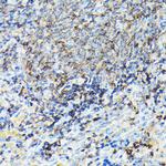 Coronin 1A Antibody in Immunohistochemistry (Paraffin) (IHC (P))