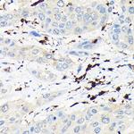 Coronin 1A Antibody in Immunohistochemistry (Paraffin) (IHC (P))