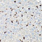 Coronin 1A Antibody in Immunohistochemistry (Paraffin) (IHC (P))