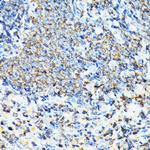 Coronin 1A Antibody in Immunohistochemistry (Paraffin) (IHC (P))