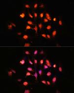 PHLPP1 Antibody in Immunocytochemistry (ICC/IF)