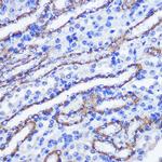 PHLPP1 Antibody in Immunohistochemistry (Paraffin) (IHC (P))