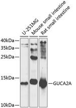 GUCA2A Antibody in Western Blot (WB)