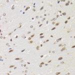 BAZ1B Antibody in Immunohistochemistry (Paraffin) (IHC (P))