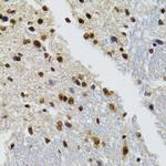 BAZ1B Antibody in Immunohistochemistry (Paraffin) (IHC (P))