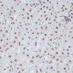 Phospho-CDK1 (Tyr15) Antibody in Immunohistochemistry (Paraffin) (IHC (P))