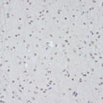 Phospho-CDK1 (Tyr15) Antibody in Immunohistochemistry (Paraffin) (IHC (P))