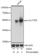 Phospho-LCK (Tyr505) Antibody in Western Blot (WB)