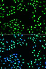 Phospho-ATR (Ser428) Antibody in Immunocytochemistry (ICC/IF)