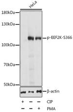 Phospho-EEF2K (Ser366) Antibody in Western Blot (WB)