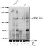 Phospho-EEF2K (Ser366) Antibody in Western Blot (WB)