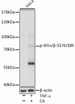 Phospho-IKK alpha/beta (Ser176, Ser180) Antibody in Western Blot (WB)