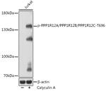 Phospho-PPP1R12A/PPP1R12B/PPP1R12C (Thr696) Antibody in Western Blot (WB)