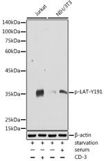 Phospho-LAT (Tyr191) Antibody in Western Blot (WB)