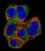 AGL Antibody in Immunocytochemistry (ICC/IF)