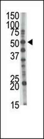 GCNT1 Antibody in Western Blot (WB)