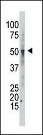 GCNT1 Antibody in Western Blot (WB)