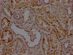 RHBDF2 Antibody in Immunohistochemistry (Paraffin) (IHC (P))