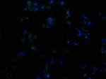 RHBDF2 Antibody in Immunocytochemistry (ICC/IF)