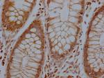 RHBDF2 Antibody in Immunohistochemistry (Paraffin) (IHC (P))