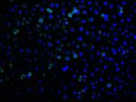 RHBDF2 Antibody in Immunocytochemistry (ICC/IF)