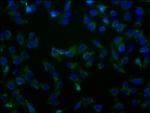 SLC23A2 Antibody in Immunocytochemistry (ICC/IF)