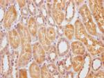 STATH Antibody in Immunohistochemistry (Paraffin) (IHC (P))