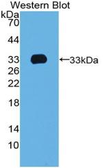 TBX4 Antibody in Western Blot (WB)