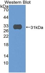 SIRP gamma Antibody in Western Blot (WB)