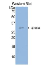 SGPL1 Antibody in Western Blot (WB)