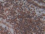 PLAA Antibody in Immunohistochemistry (Paraffin) (IHC (P))