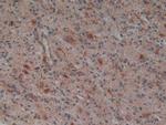 PLAA Antibody in Immunohistochemistry (Paraffin) (IHC (P))