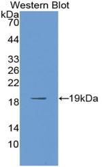 PABPC1L Antibody in Western Blot (WB)