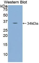 NUP98 Antibody in Western Blot (WB)