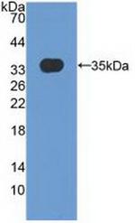 MXRA5 Antibody in Western Blot (WB)