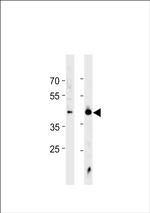 HSF1 Antibody in Western Blot (WB)