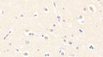 Gtf2h5 Antibody in Immunohistochemistry (Paraffin) (IHC (P))