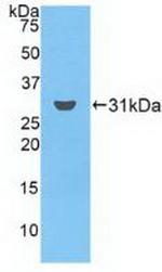 Ficolin 3 Antibody in Western Blot (WB)