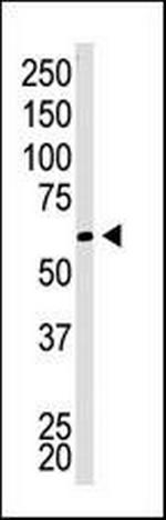 CBX4 Antibody in Western Blot (WB)