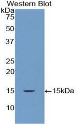 DROSHA Antibody in Western Blot (WB)