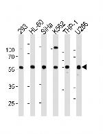 YY1 Antibody in Western Blot (WB)